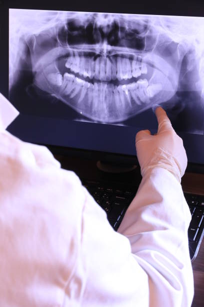 Best Emergency Wisdom Teeth Removal in Nevada City, CA