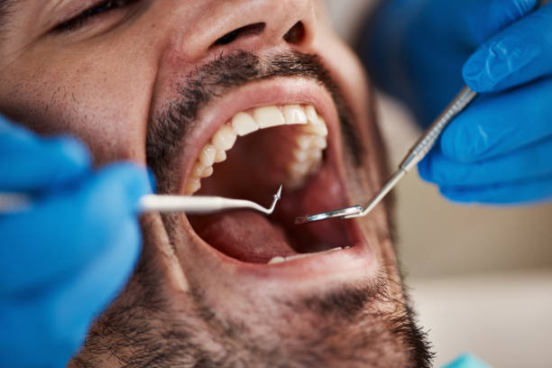 Best Emergency Denture Repair in Nevada City, CA