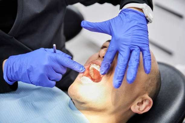 Best Emergency Treatment for Dental Infections or Abscesses in Nevada City, CA
