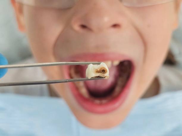 Best Same-Day Emergency Dental Services in Nevada City, CA