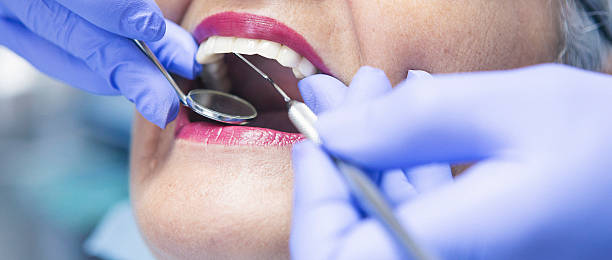 Best Emergency Tooth Extraction in Nevada City, CA