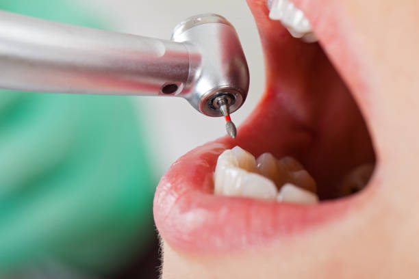 Best Pediatric Emergency Dentist in Nevada City, CA
